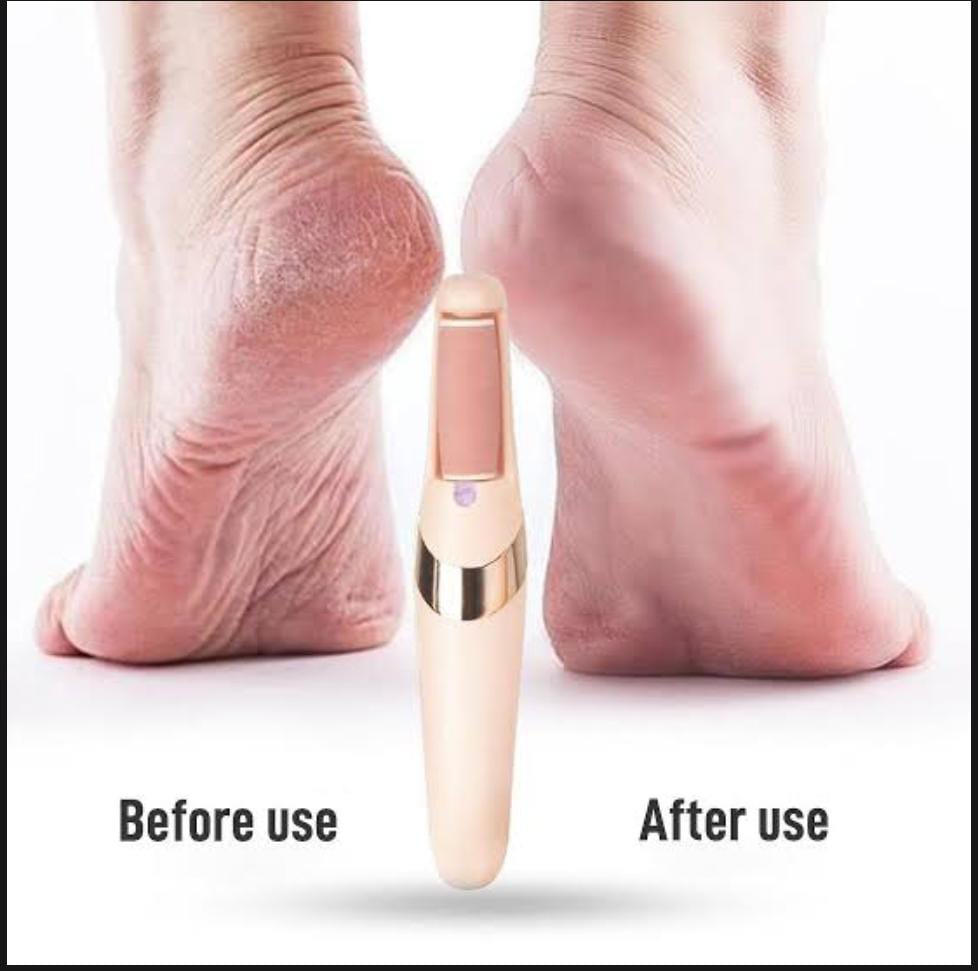 Rechargeable Electric Foot File Callus Remover - Pedicure Machine | Urban Buy